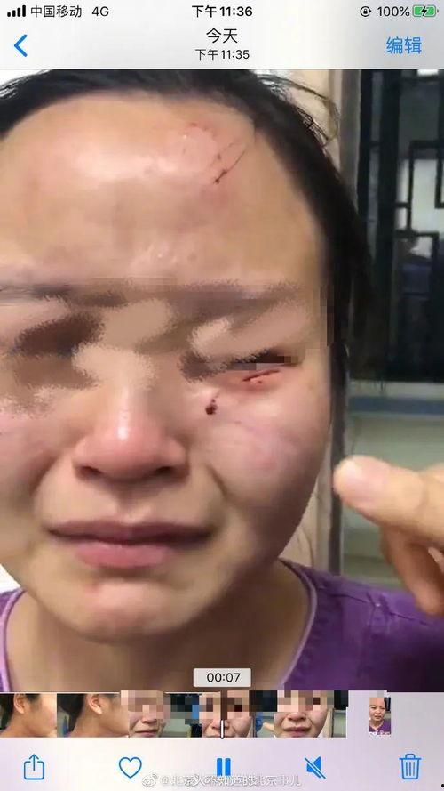 被打伤图片,探寻图片背后的故事